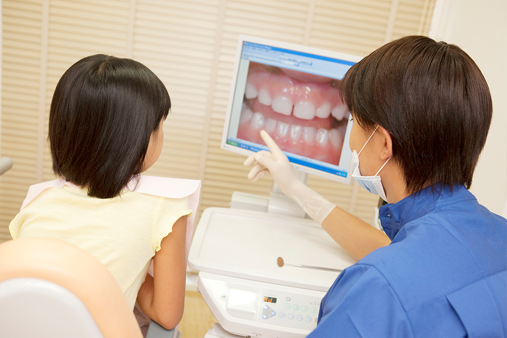 予防歯科のメリット